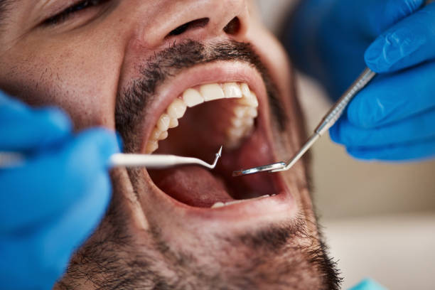 Oral Cancer Screening in Merchantville, NJ